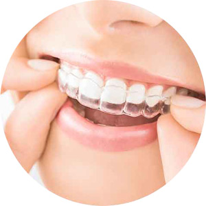 目立ちにくい・見えにくい矯正治療